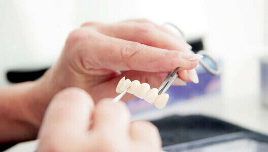 Aesthetische Zahnmedizin